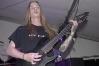 VULVODYNIA